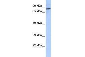 WB Suggested Anti-SPTLC2 Antibody Titration:  0. (SPTLC2 抗体  (N-Term))