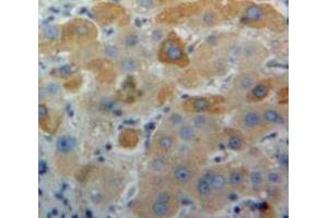 IHC-P analysis of Liver tissue, with DAB staining. (APOA1 抗体  (AA 25-264))