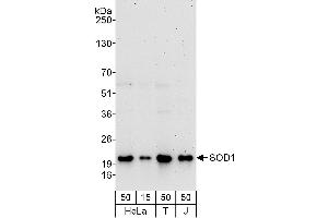 Western Blotting (WB) image for anti-Superoxide Dismutase 1, Soluble (SOD1) (AA 104-154) antibody (ABIN7454563)