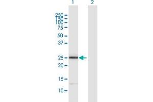 Western Blot analysis of ITGB1BP3 expression in transfected 293T cell line by ITGB1BP3 MaxPab polyclonal antibody. (ITGB1BP3 抗体  (AA 1-230))