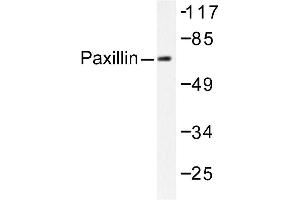 Image no. 2 for anti-Paxillin (PXN) antibody (ABIN271779) (Paxillin 抗体)