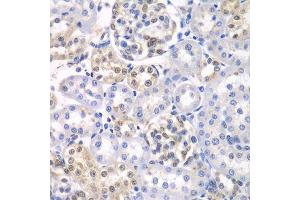 Immunohistochemistry of paraffin-embedded rat kidney using HDAC2 antibody. (HDAC2 抗体  (C-Term))