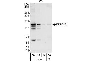 Western Blotting (WB) image for anti-Serine/threonine-Protein Kinase PRP4 Homolog (PRPF4B) (AA 1-50) antibody (ABIN7454536)