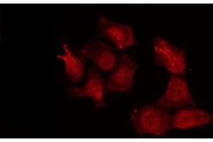 ABIN6277264 staining NIH-3T3 by IF/ICC. (MMP14 抗体  (C-Term))