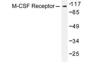 Image no. 1 for anti-Colony Stimulating Factor 1 Receptor (CSF1R) antibody (ABIN272017) (CSF1R 抗体)