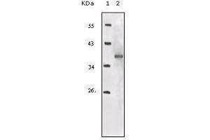 Western blot analysis using IGF1R-Beta mouse mAb against truncated IGF1R recombinant protein. (IGF1R-beta (AA 1101-1367) 抗体)