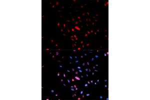 Immunofluorescence analysis of U2OS cell using Phospho-c-Jun-Ser73 antibody. (C-JUN 抗体  (pSer73))