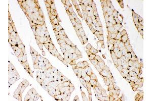Anti- Dystrophin Picoband antibody, IHC(P) IHC(P): Rat Cardiac Muscle Tissue (Dystrophin 抗体  (AA 3076-3404))