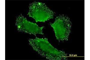 Immunofluorescence of monoclonal antibody to SH2D3C on HeLa cell.