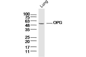 Western Blotting (WB) image for anti-Tumor Necrosis Factor (Ligand) Superfamily, Member 11 (TNFSF11) (AA 201-300) antibody (ABIN5674997)