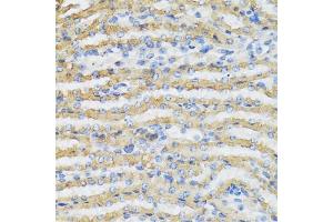 Immunohistochemistry of paraffin-embedded mouse kidney using C4BPB antibody (ABIN5973770) at dilution of 1/100 (40x lens). (C4BPB 抗体)