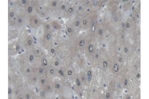 Immunohistochemistry (IHC) image for anti-Protein Tyrosine Phosphatase Receptor Type F (PTPRF) (AA 30-224) antibody (ABIN7444742)