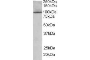 Western Blotting (WB) image for anti-TAO Kinase 3 (TAOK3) (Internal Region) antibody (ABIN2465861) (TAO Kinase 3 抗体  (Internal Region))
