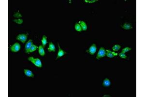 Immunofluorescence (IF) image for anti-SMAD Specific E3 Ubiquitin Protein Ligase 1 (SMURF1) (AA 198-374) antibody (ABIN7151222)