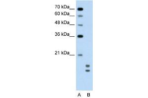 UBE2L3 antibody used at 0. (UBE2L3 抗体  (C-Term))