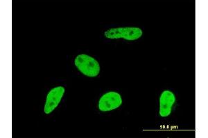 Immunofluorescence of monoclonal antibody to GMNN on HeLa cell. (Geminin 抗体  (AA 110-209))