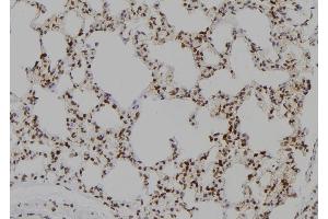 ABIN6277432 at 1/100 staining Rat lung tissue by IHC-P. (SIP1 抗体  (N-Term))