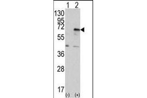 Western blot analysis of EIF2AK2 (arrow) using PRKR Antibody (C-term) (ABIN392779 and ABIN2837995). (EIF2AK2 抗体  (C-Term))