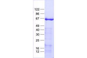 Western Blotting (WB) image for Tripartite Motif Containing 9 (TRIM9) protein (His tag) (ABIN2734305)