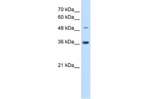 Western Blotting (WB) image for anti-Iroquois Homeobox Protein 1 (IRX1) antibody (ABIN2463089) (IRX1 抗体)