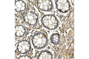 Immunohistochemistry of paraffin-embedded human colon using NEUROG3 Rabbit pAb (ABIN3016653, ABIN3016654, ABIN3016655 and ABIN6219805) at dilution of 1:250 (40x lens). (Neurogenin 3 抗体  (AA 1-83))