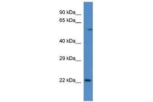 Western Blot showing Rab10 antibody used at a concentration of 1. (RAB10 抗体  (C-Term))