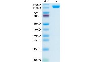 CD13 Protein (AA 69-967) (His tag)