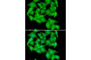 Immunofluorescence analysis of A549 cell using PRKD3 antibody. (PRKD3 抗体)