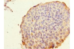 Immunohistochemistry (IHC) image for anti-Roundabout, Axon Guidance Receptor, Homolog 4 (ROBO4) (AA 848-1007) antibody (ABIN7168447)