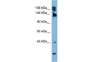 WB Suggested Anti-WNK3 Antibody Titration:  0. (WNK3 抗体  (N-Term))
