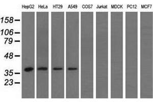 Western blot analysis of extracts (35 µg) from 9 different cell lines by using anti-HIBCH monoclonal antibody. (HIBCH 抗体)