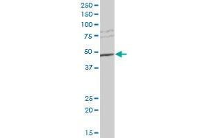 Western Blotting (WB) image for anti-Sulfotransferase Family, Cytosolic, 2B, Member 1 (SULT2B1) (AA 1-90) antibody (ABIN563063)