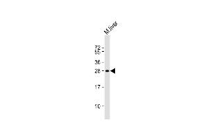 Anti-MOUSE Sike1 Antibody (N-term) at 1:1000 dilution + mouse liver lysate Lysates/proteins at 20 μg per lane. (SIKE1 抗体  (N-Term))