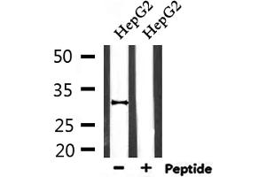 Western blot analysis of extracts from HepG2, using HO-1 Antibody. (HMOX1 抗体  (Internal Region))