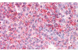 Detection of GBA in Human Spleen Tissue using Polyclonal Antibody to Glucocerebrosidase (GBA) (GBA 抗体  (AA 334-498))