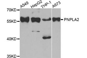 Western blot analysis of extracts of various cell lines, using PNPLA2 antibody. (PNPLA2 抗体)