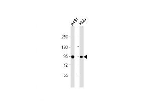 Western Blot at 1:1000 dilution Lane 1: A431 whole cell lysate Lane 2: Hela whole cell lysate Lysates/proteins at 20 ug per lane. (HSP90AB1 抗体  (AA 403-431))