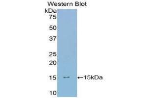 Western Blotting (WB) image for anti-Ly1 Antibody Reactive (LYAR) (AA 288-379) antibody (ABIN1859731) (LYAR 抗体  (AA 288-379))