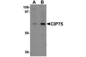 Western blot analysis of CIP75 in 3T3 cell lysate with AP30234PU-N CIP75 antibody at (A) 1 and (B) 2 μg/ml. (UBQLN4 抗体  (N-Term))
