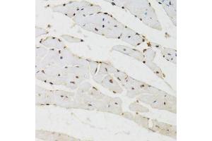 Immunohistochemistry (Paraffin-embedded Sections) (IHC (p)) image for anti-Bromodomain Adjacent To Zinc Finger Domain, 1B (BAZ1B) (AA 1-260) antibody (ABIN6137461)