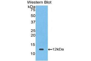 Western blot analysis of the recombinant protein. (TGFA 抗体  (AA 42-82))