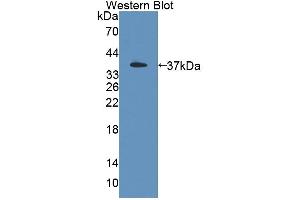 Western blot analysis of the recombinant protein. (PSG2 抗体  (AA 35-335))
