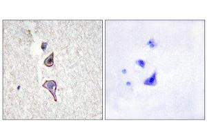 Immunohistochemistry (IHC) image for anti-Mannose Receptor, C Type 2 (MRC2) (N-Term) antibody (ABIN1850036) (MRC2 抗体  (N-Term))