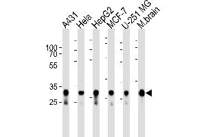 Western blot analysis of lysates from A431, Hela, HepG2, MCF-7, U-251 MG cell lines and mouse brain tissue lysate (from left to right), using CYC1 Antibody (Center) (ABIN1944852 and ABIN2838554). (Cytochrome C1 抗体  (AA 142-176))