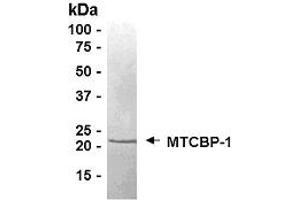 Western Blotting (WB) image for Acireductone Dioxygenase 1 (ADI1) (AA 1-179) protein (ABIN2468869) (ADI1 Protein (AA 1-179))