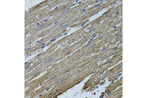 Immunohistochemistry of paraffin-embedded rat heart using MAP1B antibody (ABIN5971696) at dilution of 1/100 (40x lens). (MAP1B 抗体)