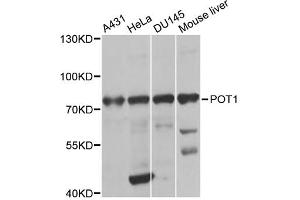 Western blot analysis of extracts of various cell lines, using POT1 antibody (ABIN2650945) at 1:1000 dilution. (POT1 抗体)