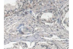 Detection of FBLN1 in Human Prostate Tissue using Monoclonal Antibody to Fibulin 1 (FBLN1) (Fibulin 1 抗体  (AA 176-398))