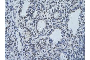 Rabbit Anti-SF3B1 Antibody       Paraffin Embedded Tissue:  Human alveolar cell   Cellular Data:  Epithelial cells of renal tubule  Antibody Concentration:   4.