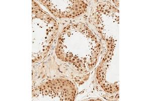 Immunohistochemistry (Paraffin-embedded Sections) (IHC (p)) image for anti-Proteasome (Prosome, Macropain) 26S Subunit, Non-ATPase, 3 (PSMD3) (AA 482-515) antibody (ABIN6243826)